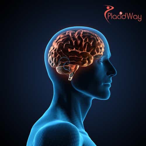 Stem Cell Therapy for Traumatic Brain Injury: A Guide to Advanced Regenerative Treatment in the UAE and Beyond